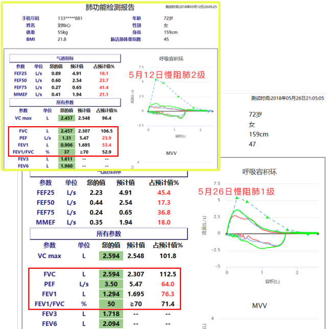 慢阻肺-呼吸訓練器-肺功能檢測儀-肺炎-哮喘-海滄-賽客-咳喘