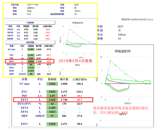 慢阻肺-呼吸訓練器-肺功能檢測儀-肺炎-哮喘-海滄-賽客-咳喘