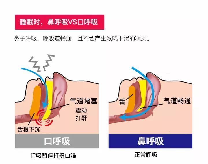 肺炎-哮喘-慢阻肺-咳嗽-咳喘-支氣管炎-肺功能檢測儀-呼吸訓練器-心臟病-心血管疾病-口呼吸-整容-呼吸峰流速儀